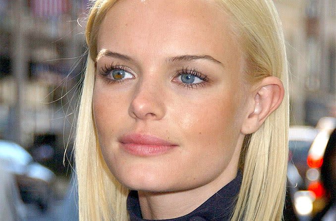 Famous People Who Have Heterochromia