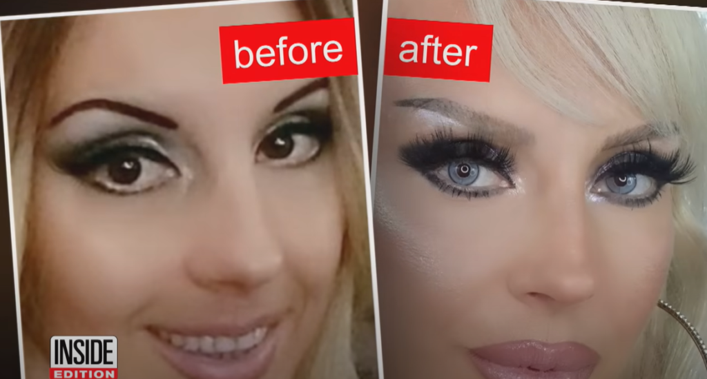 Eye Color Changing Surgery: A Controversial Procedure Gaining Popularity