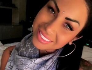 Nadinne Bruna and Her Colombian Iris Implants: A Harsh Lesson in Cosmetic Eye Color Surgery