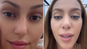 Layyons Valença and Her Keratopigmentation Experience: A Real Look at Cosmetic Eye Color Surgery