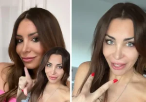 Daniela Requena and Eye Color Change Surgery: What You Must Know About Keratopigmentation