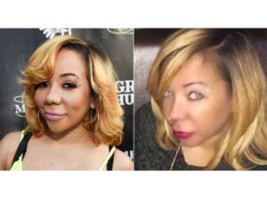 Tameka “Tiny” Harris Silicone Iris Implant: Safe Cosmetic Eye Surgery or Risky Trend?